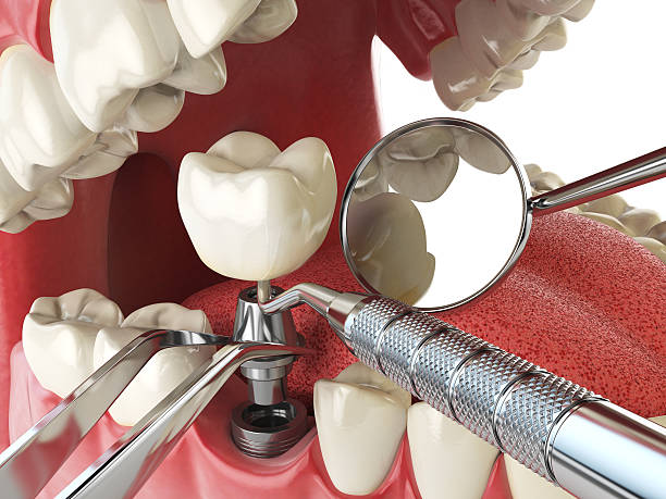 Best Dentist for Tooth Abscess  in Baldwin City, KS