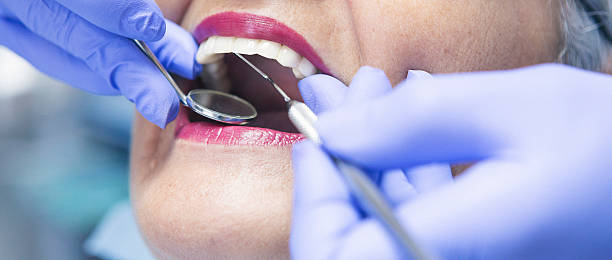 Emergency Dental Filling Replacement in KS
